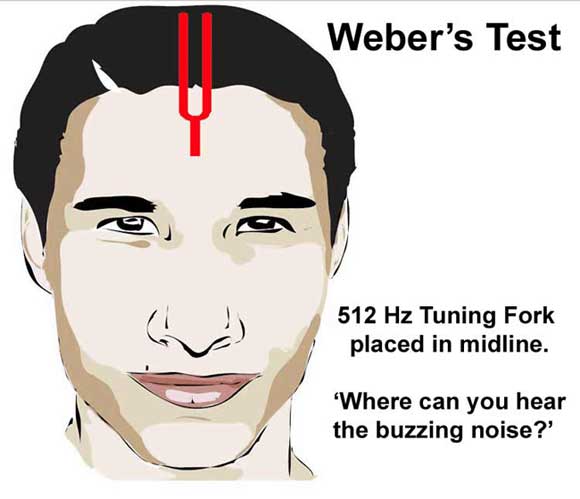 weber's test